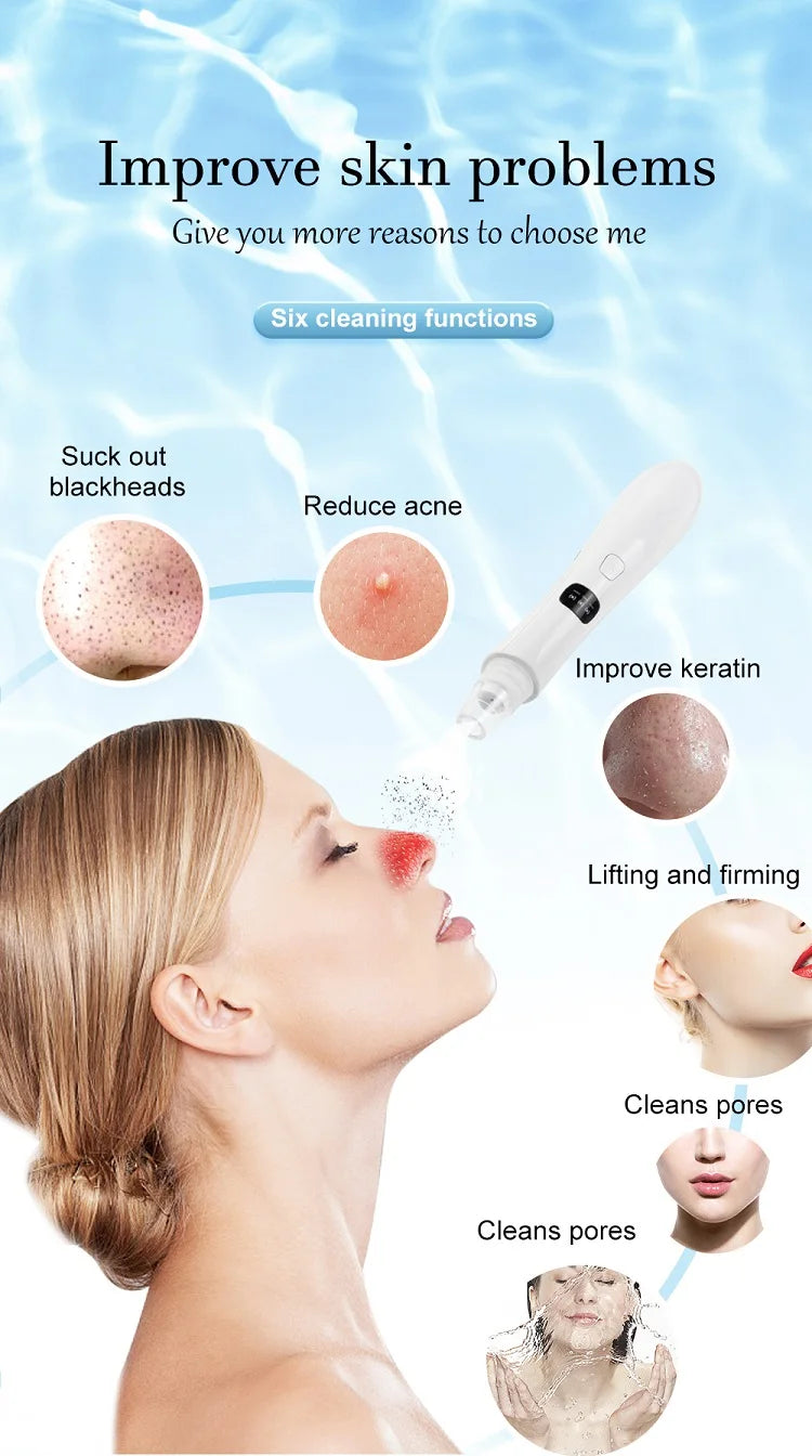 Dead Skin and Blackhead Removal Vacuum