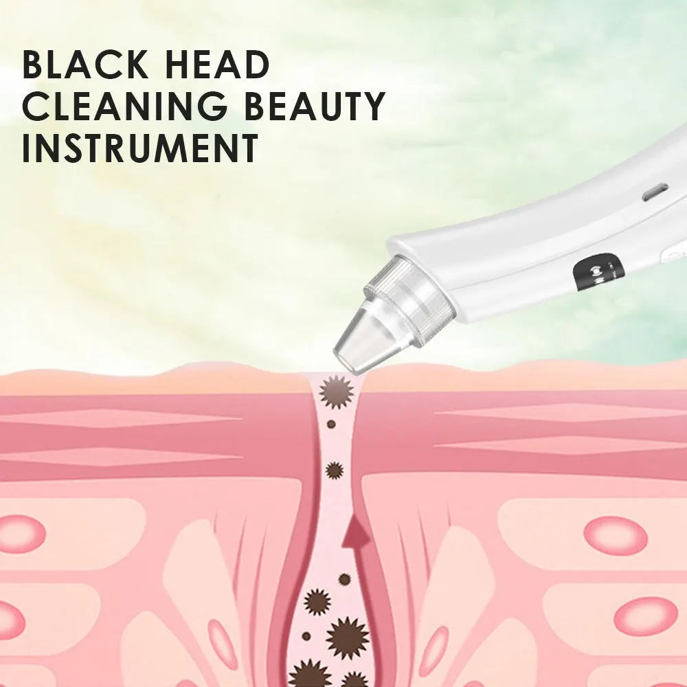 Dead Skin and Blackhead Removal Vacuum