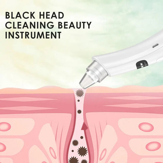 Dead Skin and Blackhead Removal Vacuum
